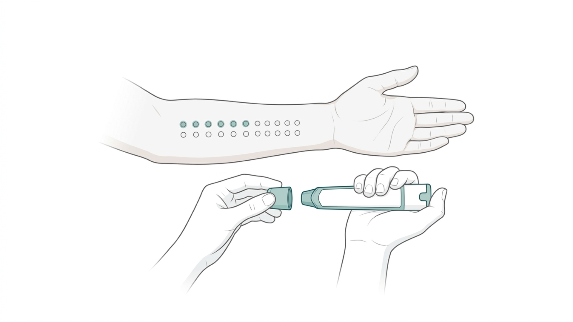 Medical line illustration of allergy testing and adrenaline auto-injector training for Component-resolved allergy testing.