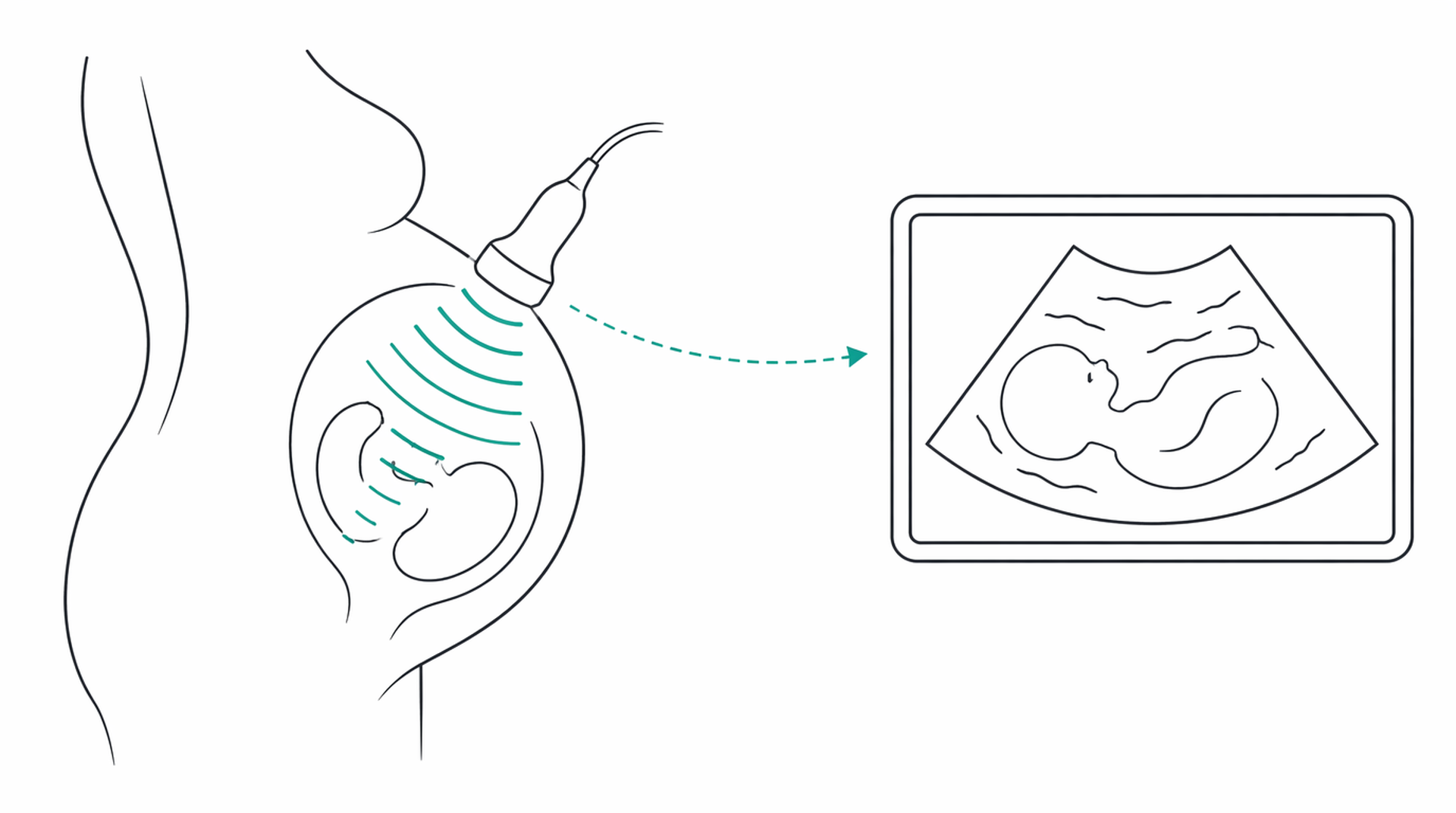 Medical line illustration of antenatal pregnancy scan for Antenatal care and pregnancy scans.