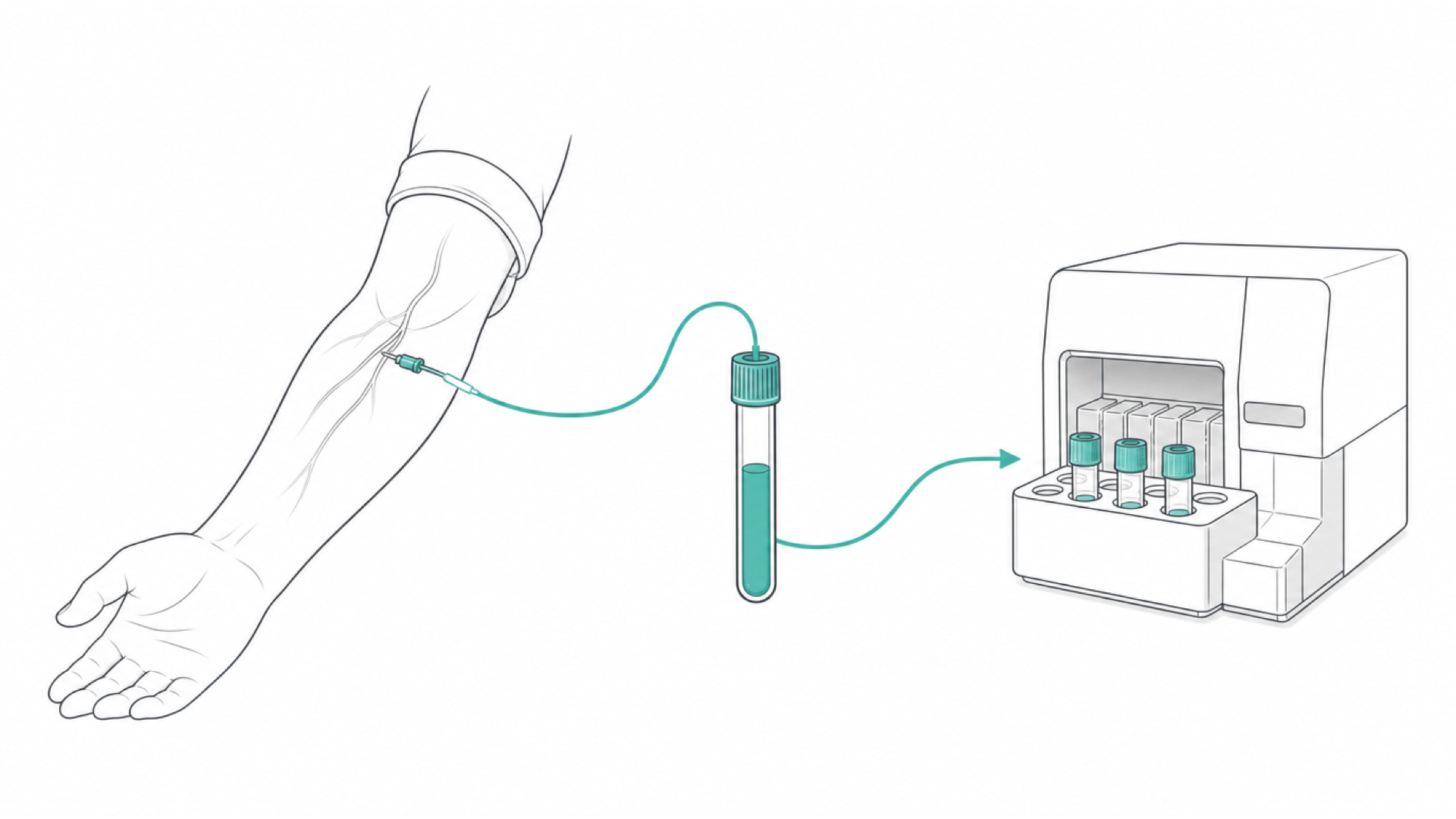 Medical line illustration of blood sampling and laboratory analysis for HIV test.