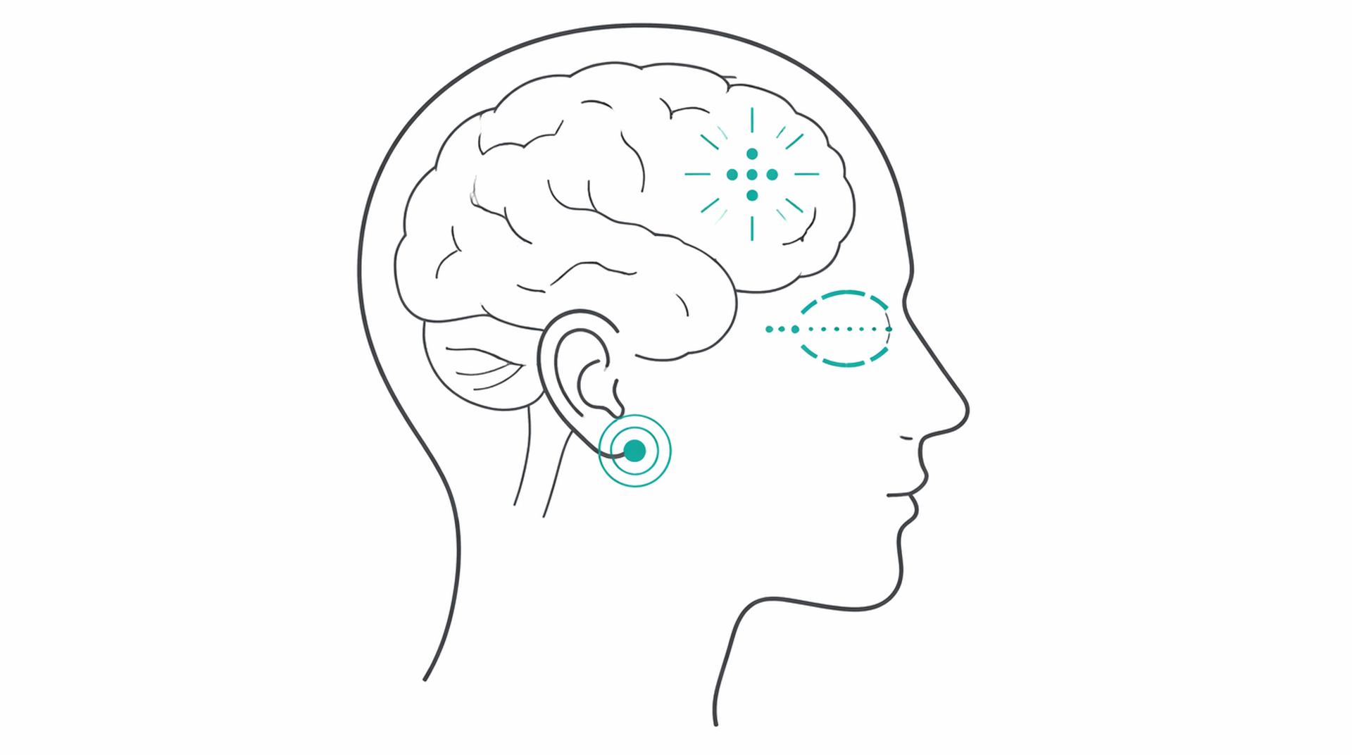 Medical line illustration of concussion sports head injury for Return-to-sport assessment.