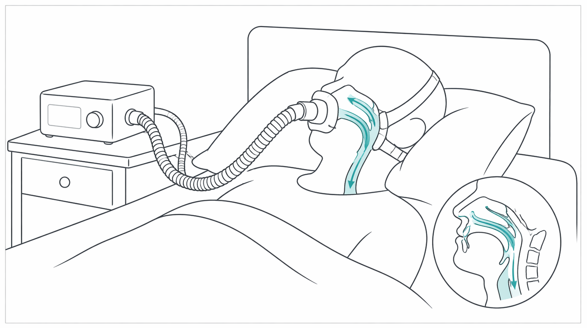Medical line illustration of cpap sleep apnoea therapy for Home sleep study.