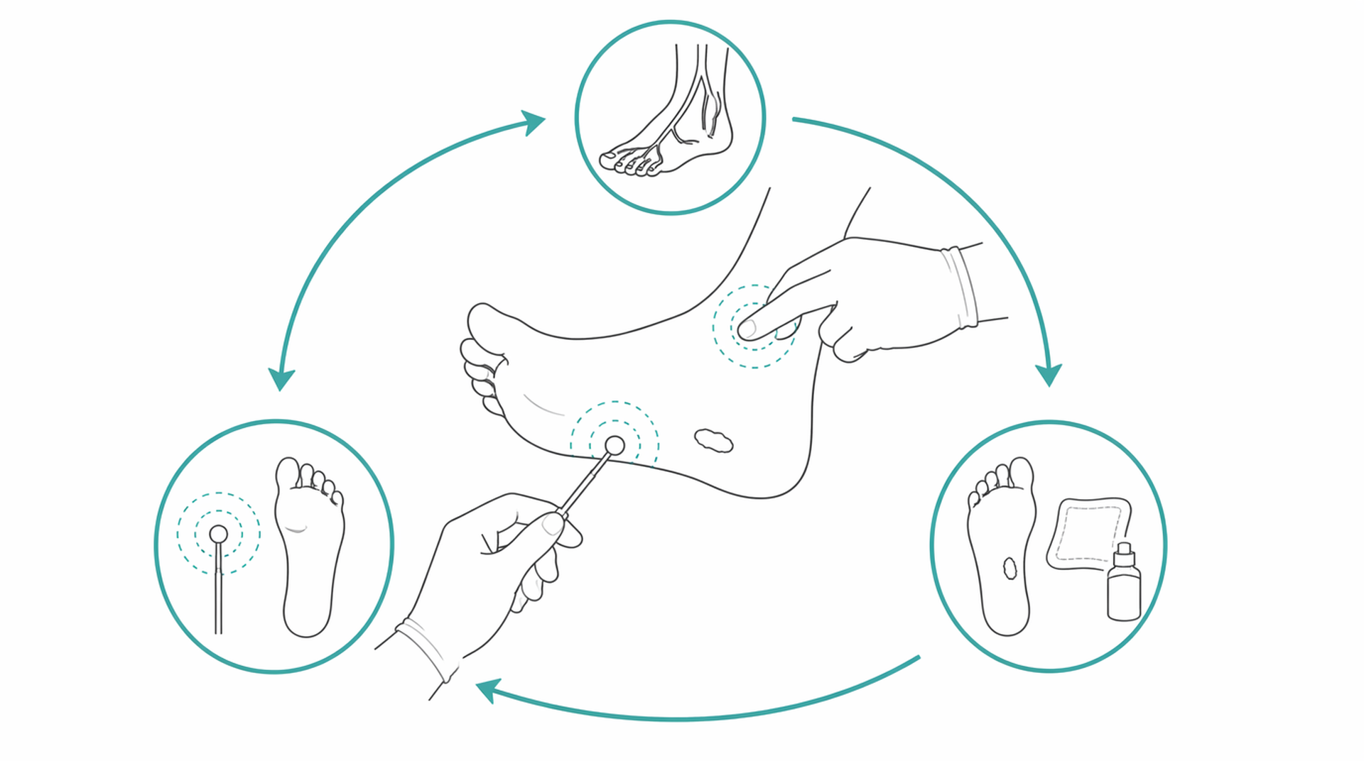 Medical line illustration of diabetic foot wound for Diabetic foot check.