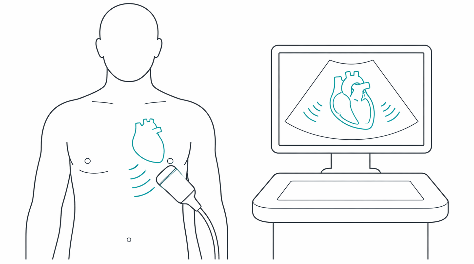 Medical line illustration of echocardiogram heart ultrasound for Echocardiogram (heart ultrasound).