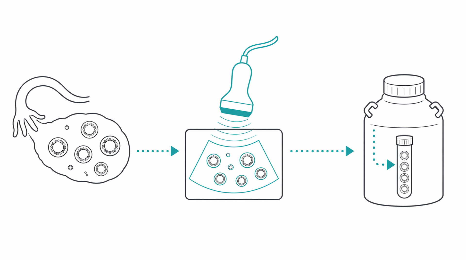 Medical line illustration of egg freezing fertility preservation for Egg donation / using donor eggs.