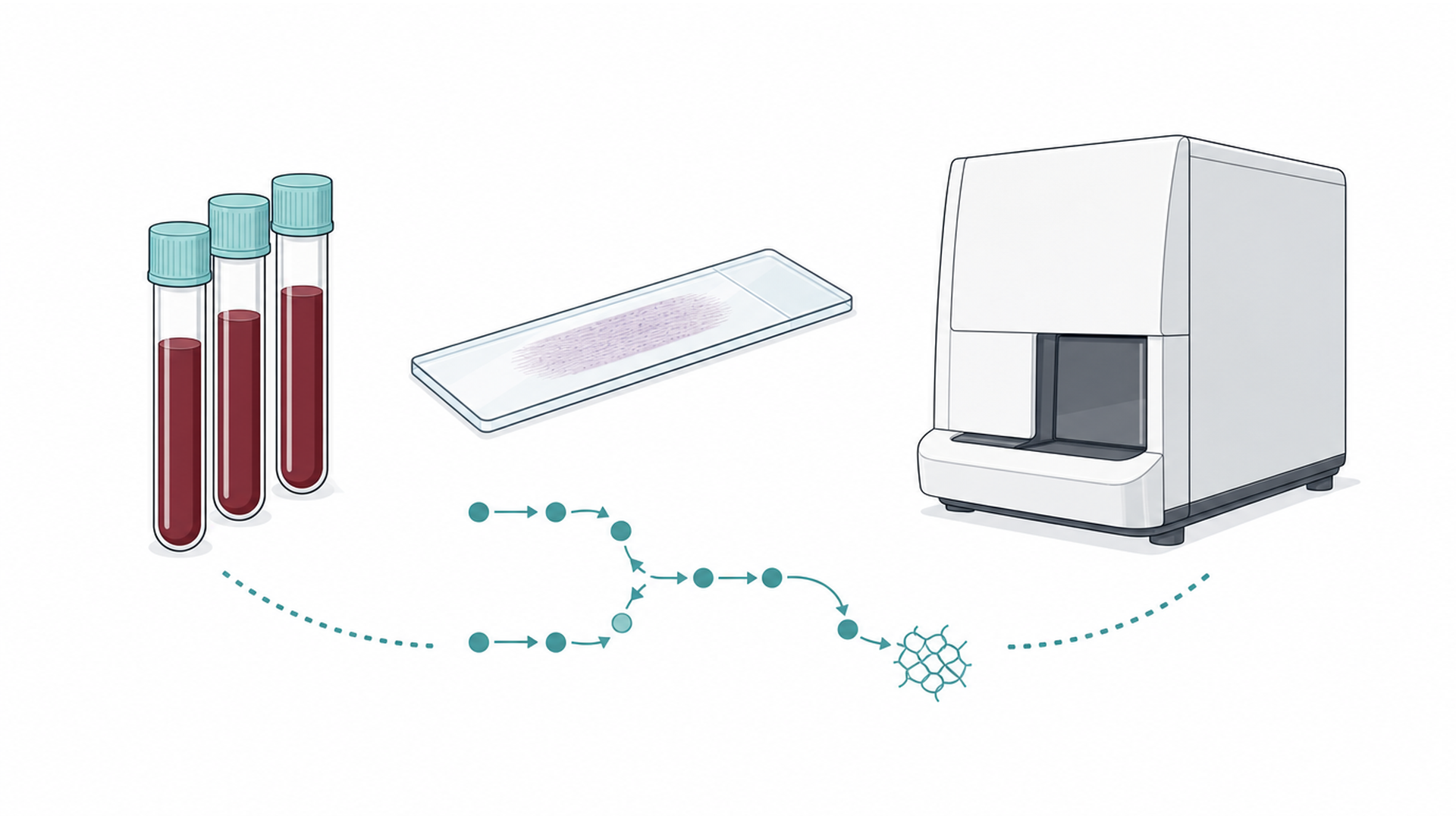 Medical line illustration of blood samples, a clotting pathway and haematology analysis for Anticoagulation (blood-thinning treatment).
