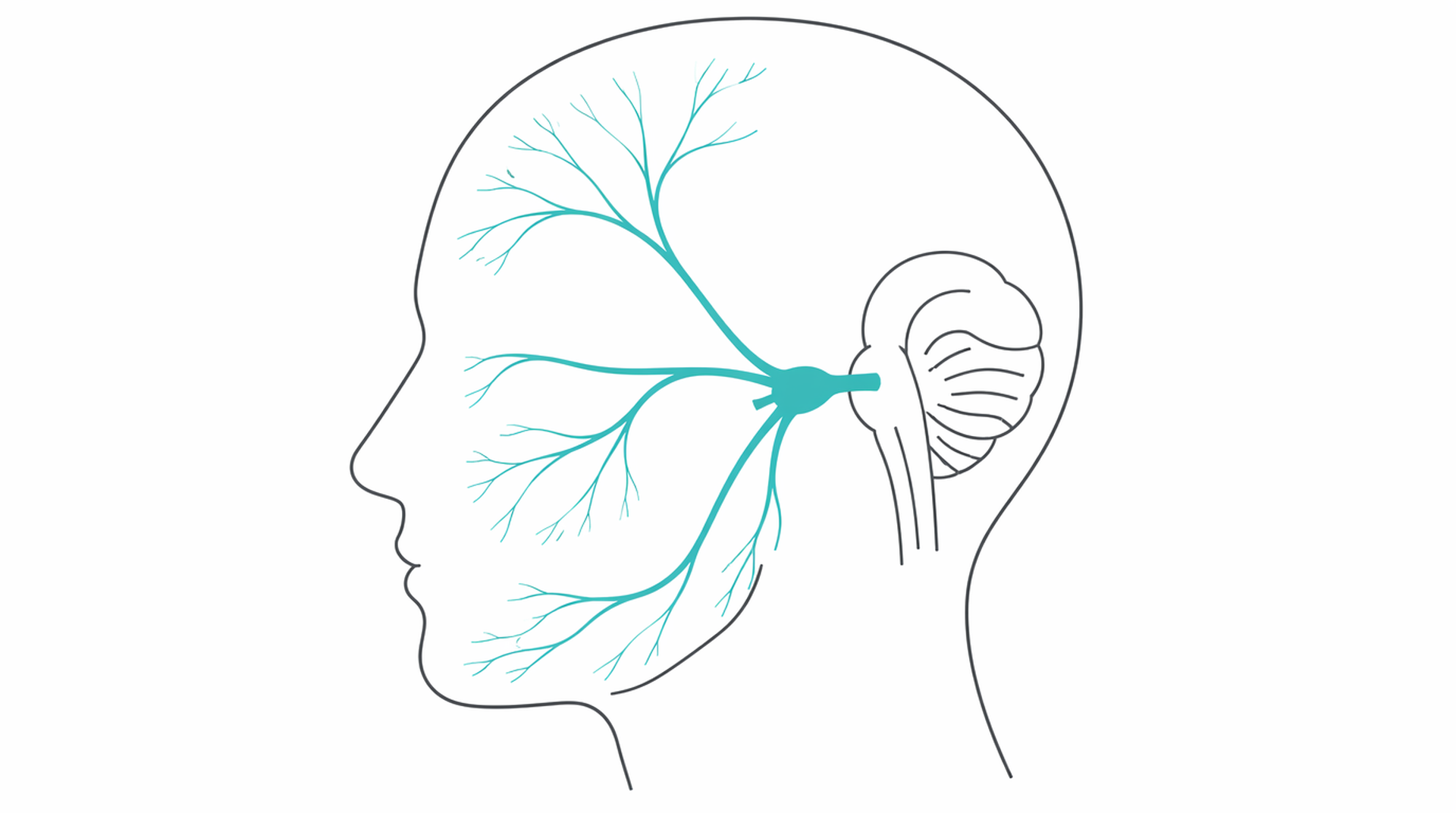 Medical line illustration of headache migraine neurology for Acute headache assessment.