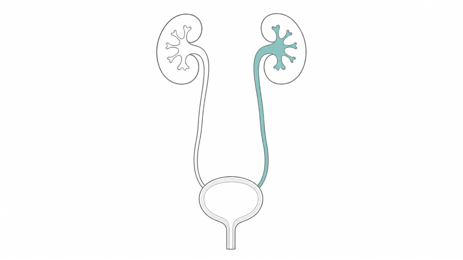 Medical line illustration of the kidneys, ureters and bladder for Glomerulonephritis management.