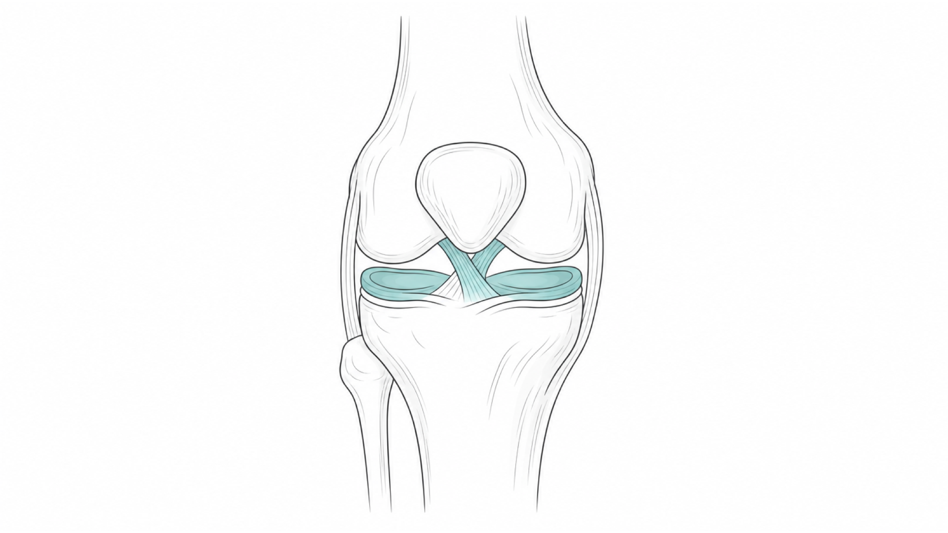 Medical line illustration of the knee joint for Joint injections (steroid or hyaluronic acid).