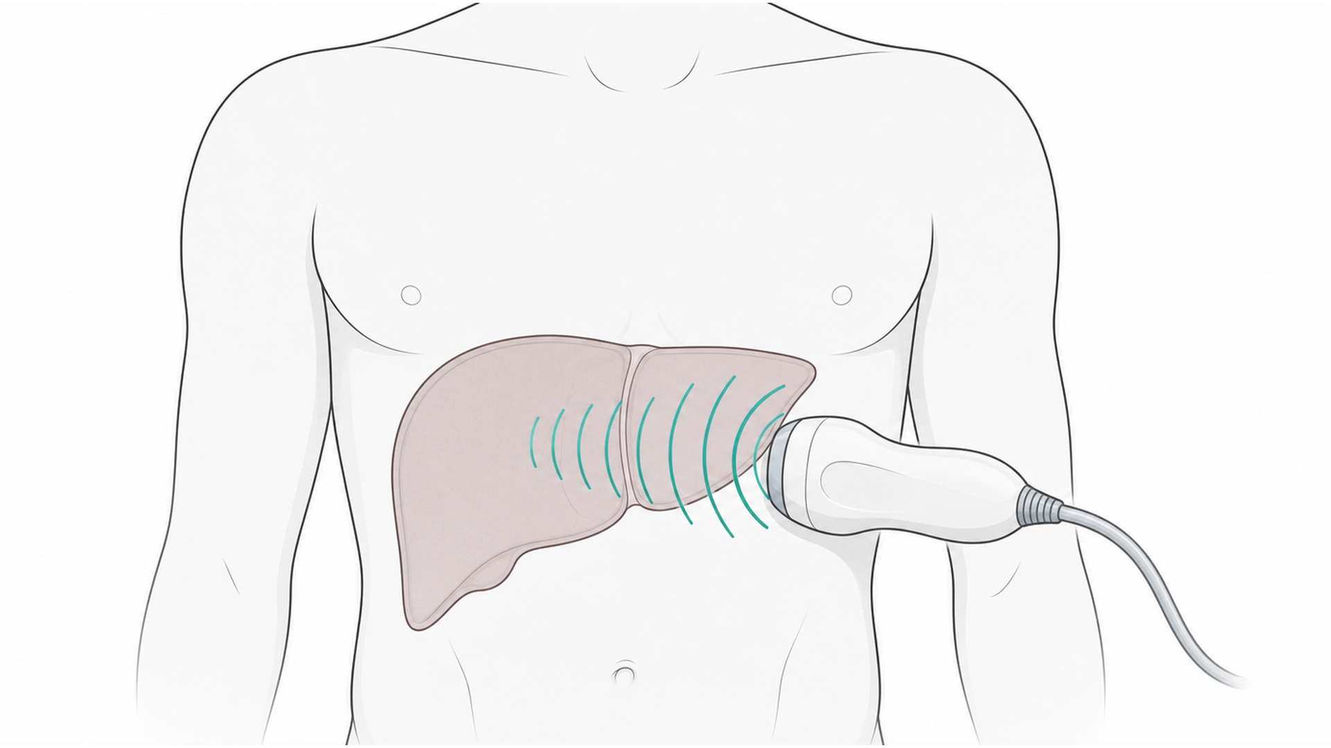 Medical line illustration of liver fibroscan ultrasound for FibroScan (liver scan).