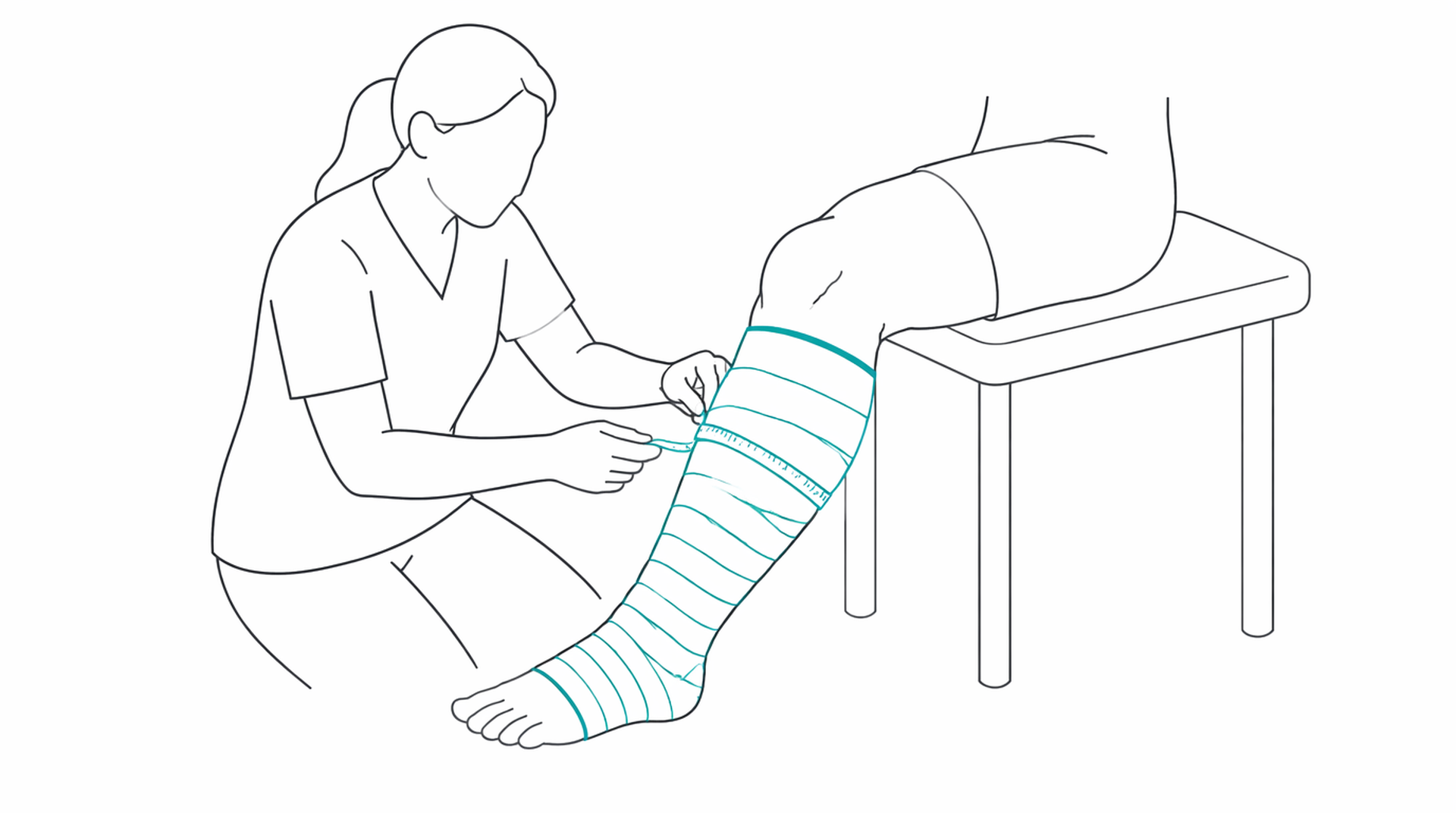 Medical line illustration of lymphoedema compression therapy for Lymphoedema surgery.