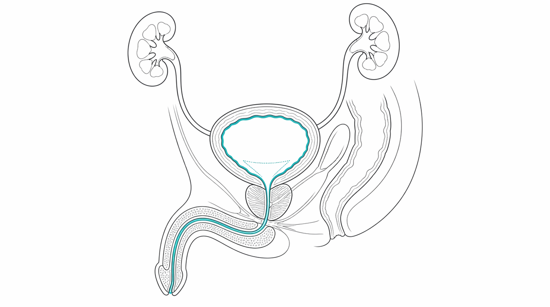Medical line illustration of male lower urinary tract anatomy for Bladder Botox injections.