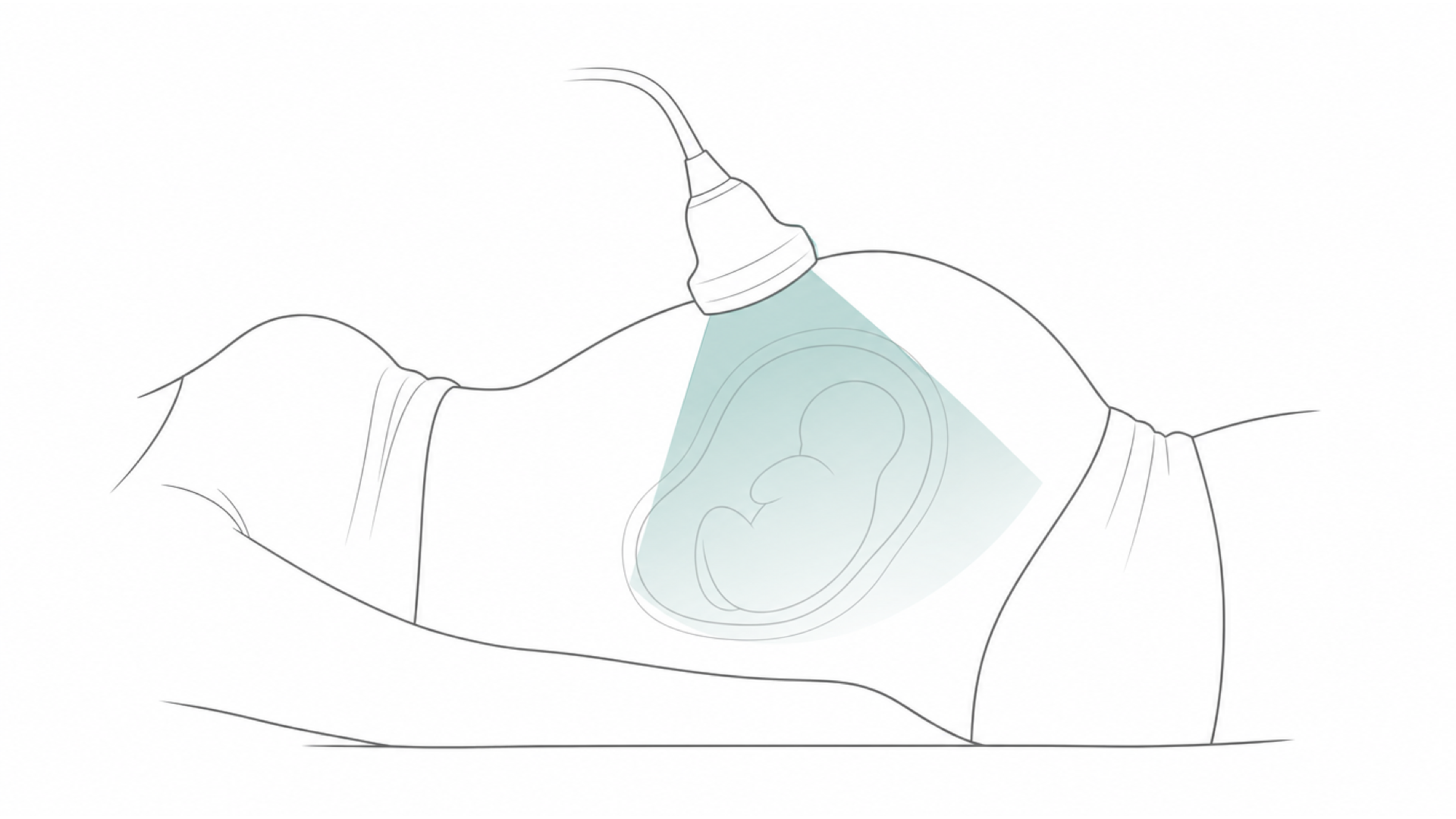 Medical line illustration of pregnancy ultrasound for Pre-conception advice.