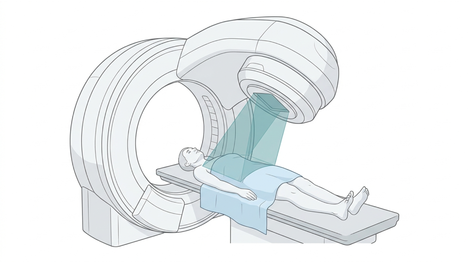 Medical line illustration of radiotherapy treatment for External beam radiotherapy.