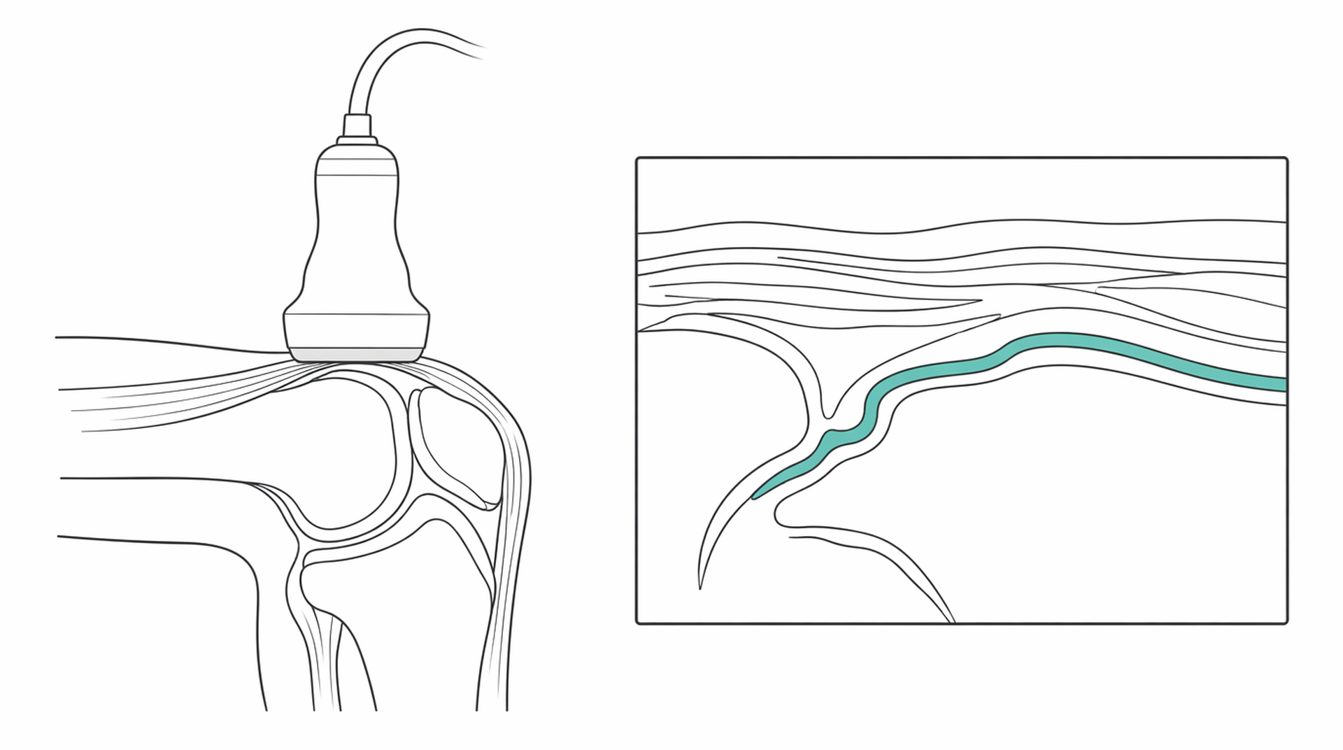 Medical line illustration of rheumatology joint ultrasound for Rheumatology consultation.