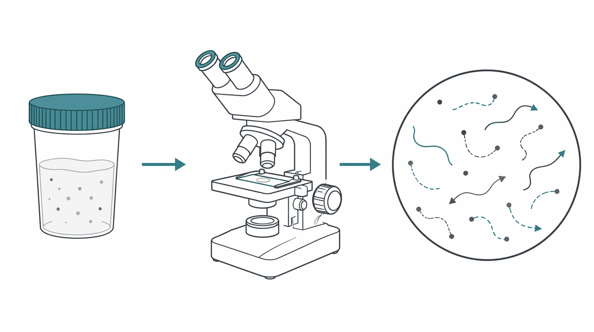 Medical line illustration of sperm analysis male fertility for Semen analysis.
