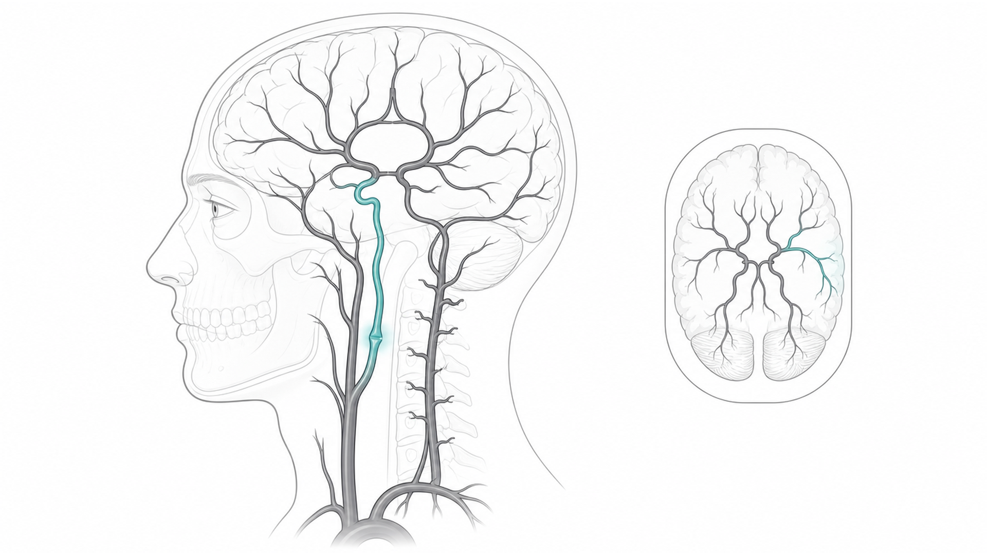 Medical line illustration of brain and neck blood vessels for Stroke prevention assessment.