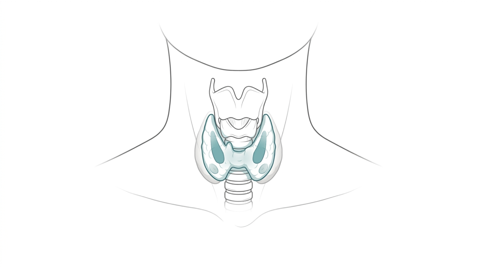 Medical line illustration of thyroid and neck endocrine anatomy for Thyroid surgery (thyroidectomy).