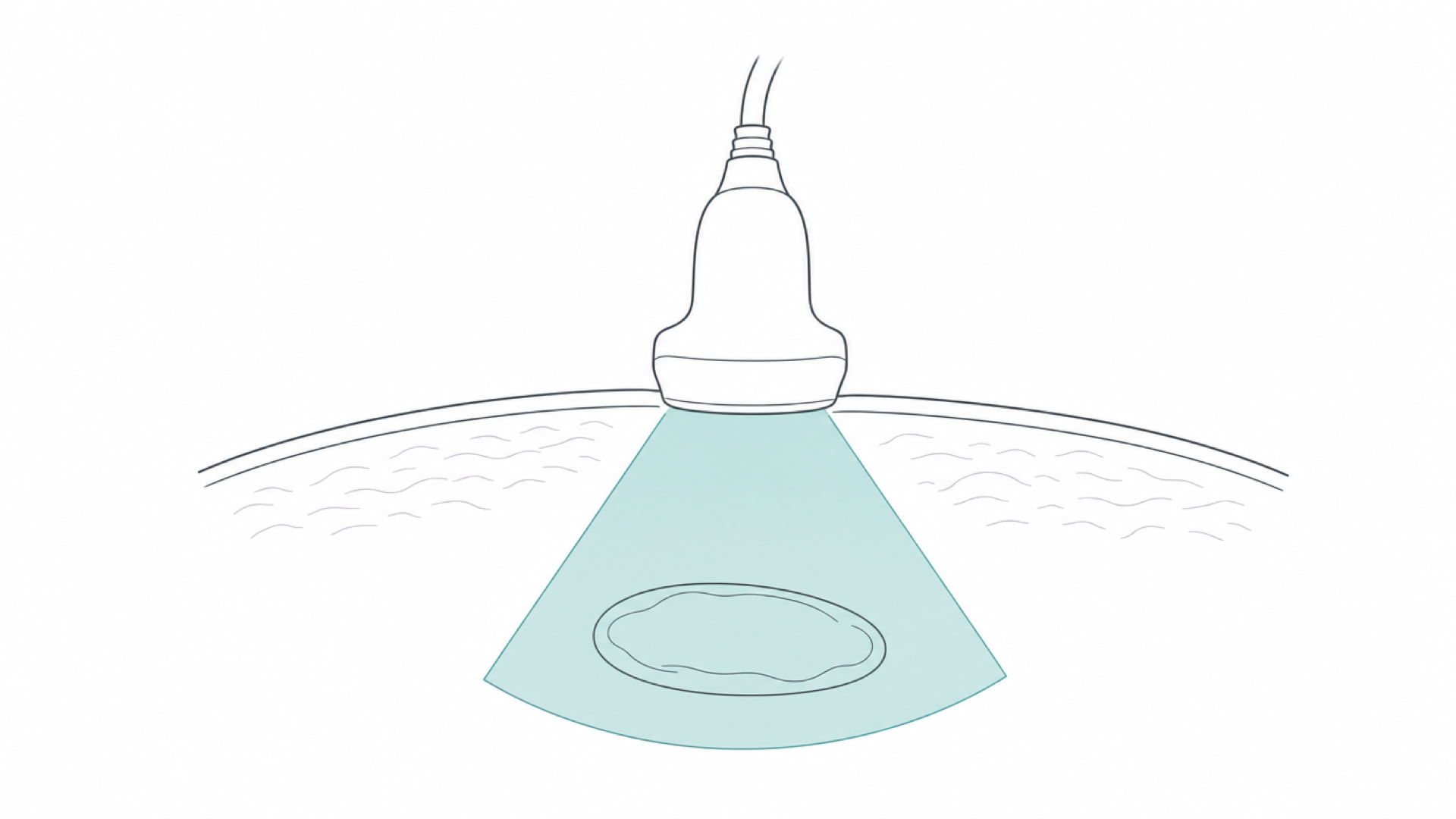 Medical line illustration of an ultrasound probe scanning beneath the skin for Same-day diagnostic scans.