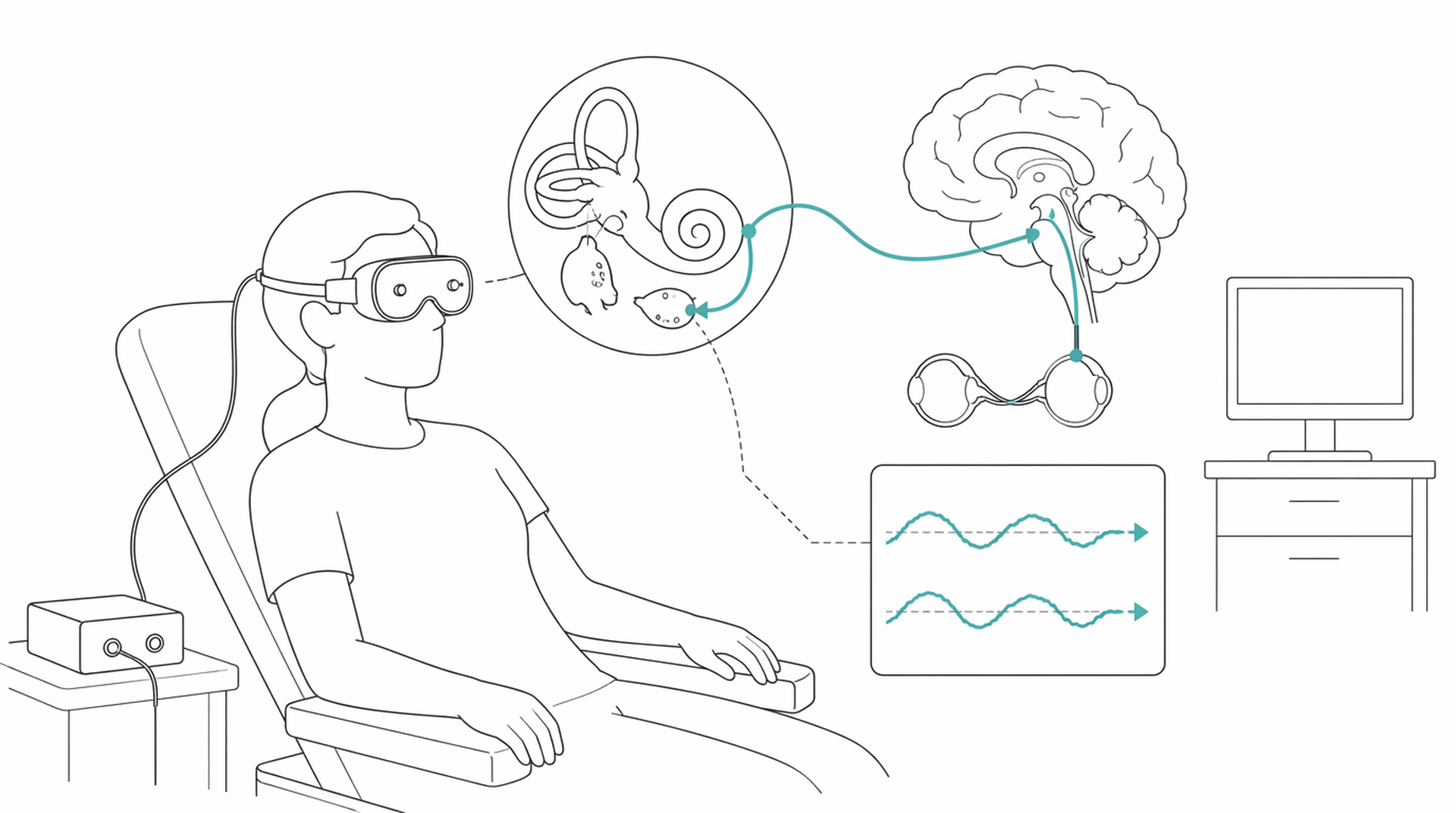Medical line illustration of vestibular balance testing for Caloric testing.