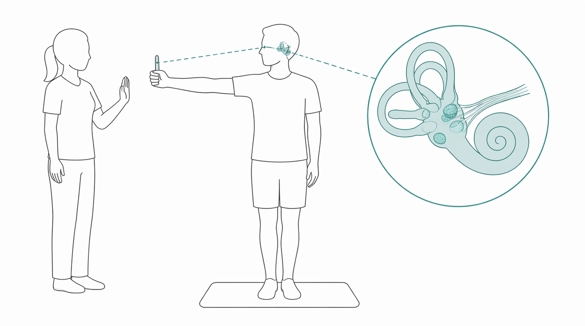 Medical line illustration of vestibular rehabilitation exercises for Epley manoeuvre (BPPV repositioning treatment).