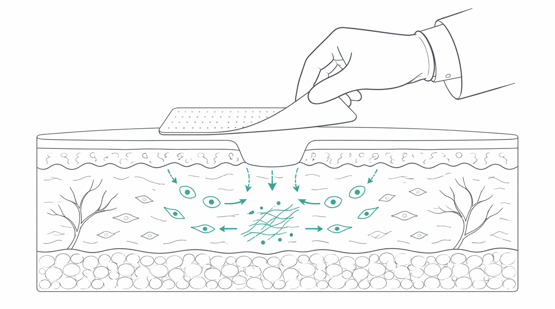 Medical line illustration of wound dressings tissue healing for Dressings and wound care.